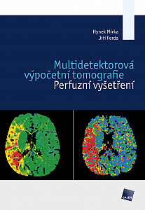 E-kniha Multidetektorová výpočetní tomografie