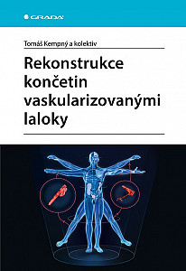 E-kniha Rekonstrukce končetin vaskularizovanými laloky
