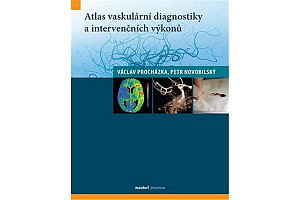 Atlas vaskulární diagnostiky a intervenčních výkonů