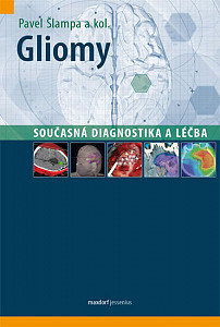 Gliomy - současná diagnostika a léčba
