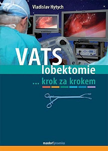 VATS lobektomie