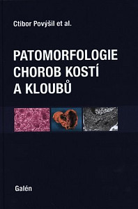 Patomorfologie chorob kostí a kloubů