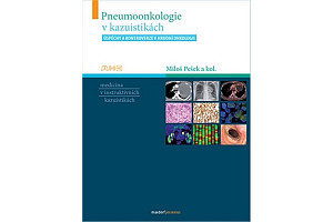 Pneumoonkologie v kazuistikách