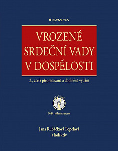 Vrozené srdeční vady v dospělosti
