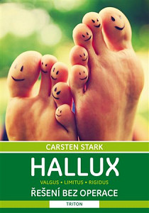 Hallux Řešení bez operace