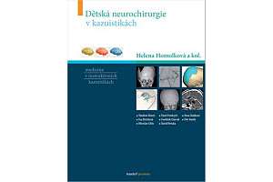 Dětská neurochirurgie v kazuistikách
