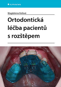 Ortodontická léčba pacientů s rozštěpem