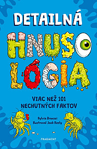 Detailná HNUSOLÓGIA: Viac než 101 nechutných faktov