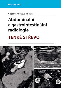 E-kniha Abdominální a gastrointestinální radiologie