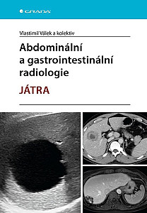 E-kniha Abdominální a gastrointestinální radiologie