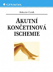 E-kniha Akutní končetinová ischemie