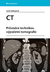 E-kniha CT - Průvodce technikou výpočetní tomografie