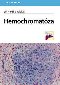 E-kniha Hemochromatóza