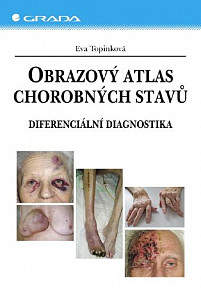 E-kniha Obrazový atlas chorobných stavů