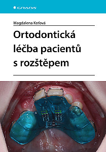 E-kniha Ortodontická léčba pacientů s rozštěpem