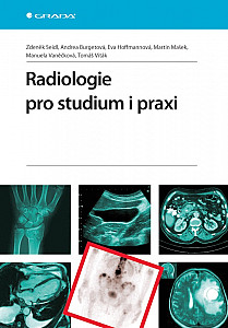 E-kniha Radiologie pro studium i praxi