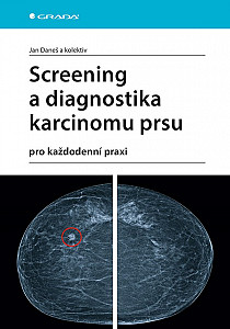 E-kniha Screening a diagnostika karcinomu prsu