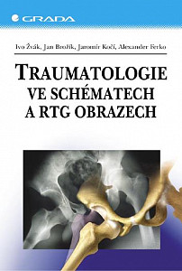 E-kniha Traumatologie ve schématech a RTG obrazech