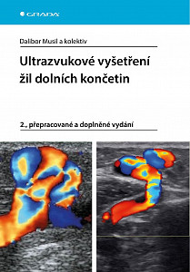 E-kniha Ultrazvukové vyšetření žil dolních končetin