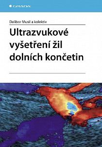 E-kniha Ultrazvukové vyšetření žil dolních končetin