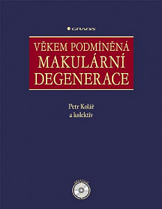 E-kniha Věkem podmíněná makulární degenerace