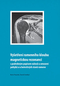 E-kniha Vyšetření ramenního kloubu magnetickou rezonancí s podrobným popisem nálezů u omezení pohybů u bolestivých stavů ramene