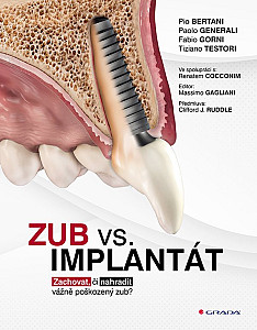 E-kniha Zub vs. implantát