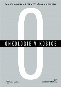 Onkologie v kostce