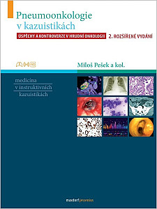 Pneumoonkologie v kazuistikách - Úspěchy a kontroverze v hrudní chirurgii