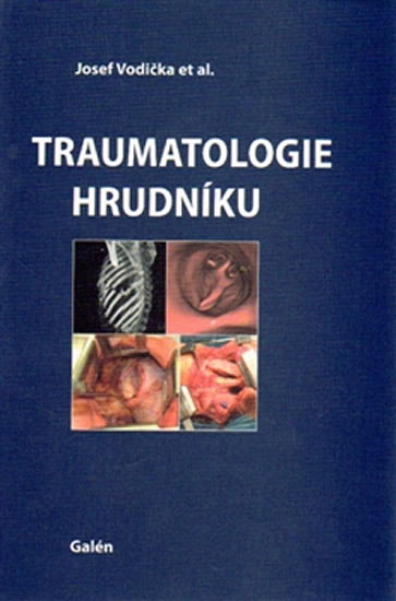 Traumatologie hrudníku