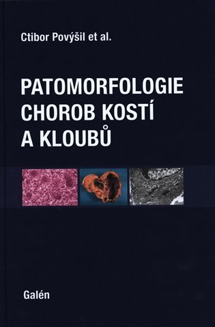 Patomorfologie chorob kostí a kloubů