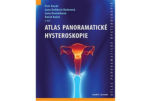Atlas panoramatické hysteroskopie