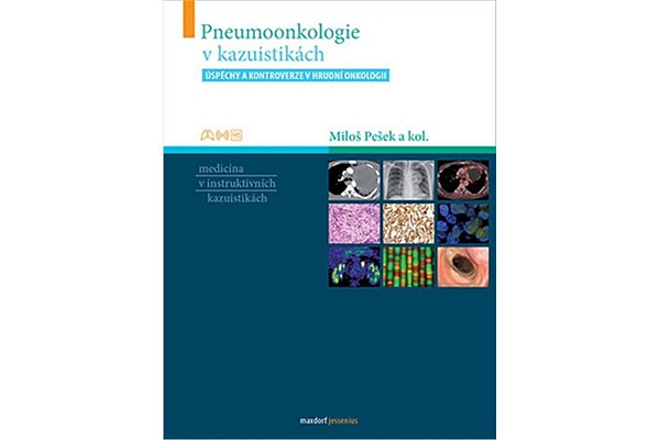 Pneumoonkologie v kazuistikách