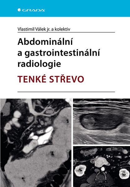 E-kniha Abdominální a gastrointestinální radiologie