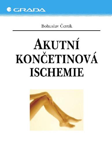 E-kniha Akutní končetinová ischemie