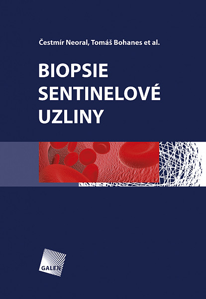 E-kniha Biopsie sentinelové uzliny