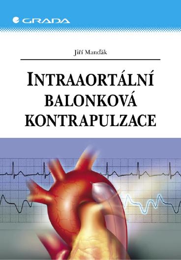 E-kniha Intraaortální balonková kontrapulzace