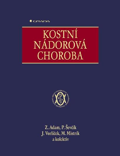 E-kniha Kostní nádorová choroba