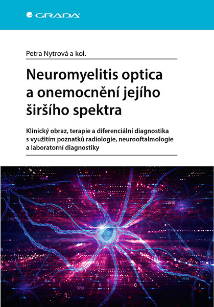 E-kniha Neuromyelitis optica a onemocnění jejího širšího spektra