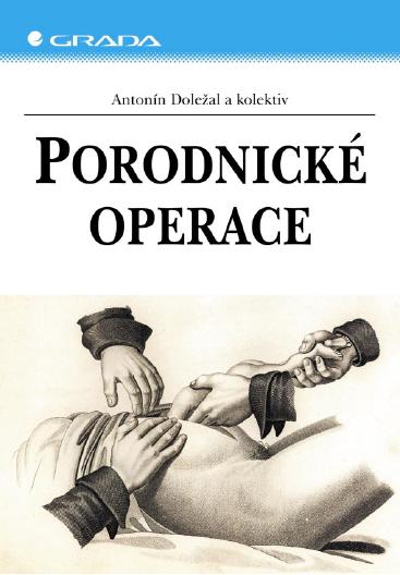 E-kniha Porodnické operace