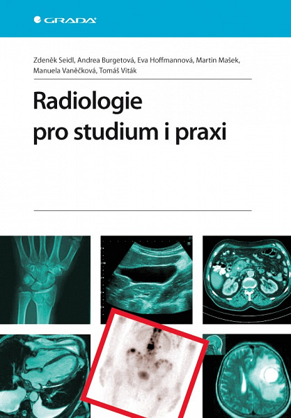 E-kniha Radiologie pro studium i praxi
