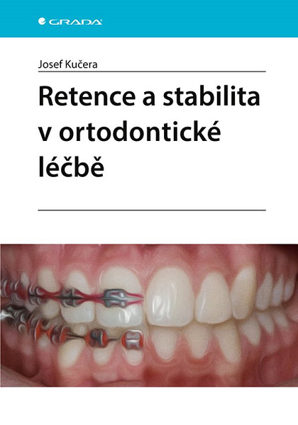 E-kniha Retence a stabilita v ortodontické léčbě