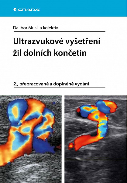 E-kniha Ultrazvukové vyšetření žil dolních končetin