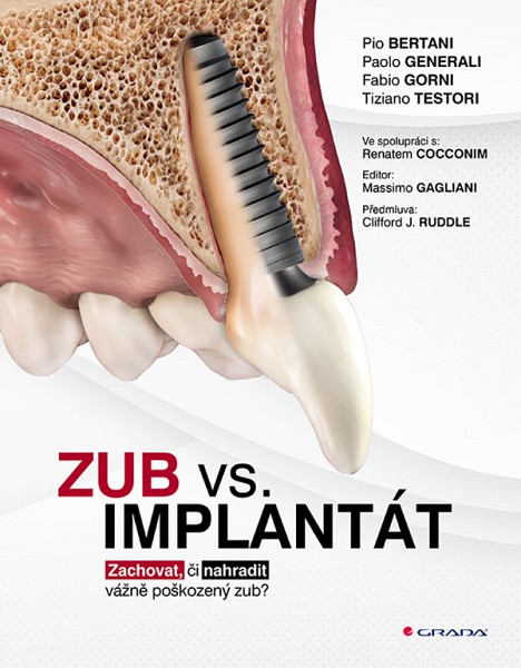 E-kniha Zub vs. implantát